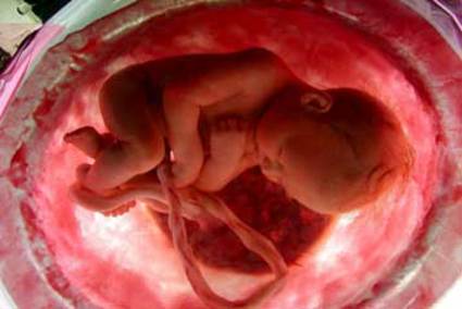 Εντυπωσιακό βίντεο: Το έμβρυο από τη σύλληψη ως τη γέννηση! - Εικόνα 2