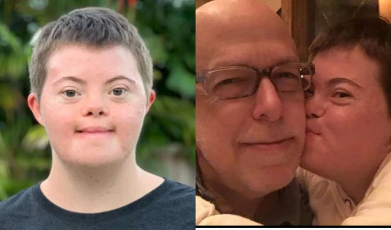 Κόρη με σύνδρομο Down αποφοίτησε από το Πανεπιστήμιο – Μια ιστορία επιτυχίας