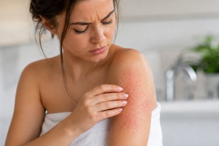 Γιατί το δέρμα σας ερεθίζεται μετά το μπάνιο: Αίτια και τρόποι προστασίας